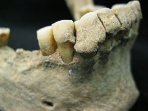 dental calculus archaeology